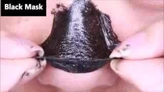 Вакуумная Чистка Черных Точек [Чистка Черных Точек]