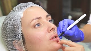 ПОСЛЕ-операционная коррекция ГУБ, лица, тела