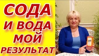 Сода без Воды - не туды и не сюды!!!! И. П . Неумывакин, мой результат и советы от меня.