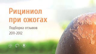 РИЦИНИОЛ применение при ожогах
