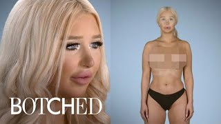 Plastic Surgery Almost Killed Amanda | Botched | E!