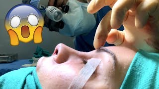 NOSE JOB VLOG! REVEALING MY NEW NOSE!