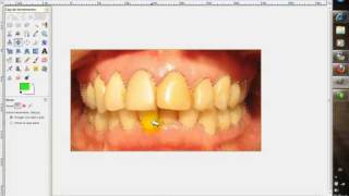 gimp:blanquear dientes