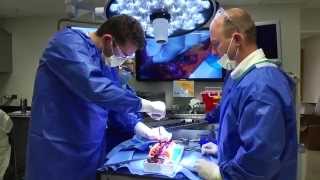 Simulation Training for Future Pediatric Orthopedic Surgeons - Akron Children's Hospital video