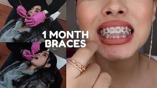 1 MONTH BRACES UPDATE + FIRST TIGHTENING VLOG