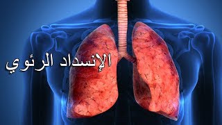 5- الإنسداد الرئوي : الأعراض وكيفية الوقاية وطرق العلاج