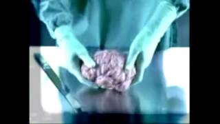 социальный ролик о вреде курения anti smoking ad