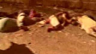 Terrifying effects of chemical weapons on the people of Iraq