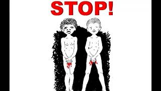 AHRC Commissioner Edward Santow Wriggles Out on Male Circumcision