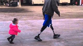 Double Amputee Walking