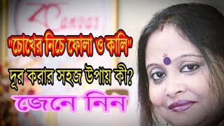"চোখের নিচে কালি ও ফোলাভাব" দূর করার সহজ উপায় জেনে নিন।