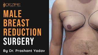 Relief From Gynecomastia | Surgery Video | Scar Free Male Chest Reduction | Man Boobs |Dezire Clinic