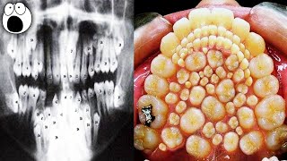 Weird Ways People Have Recently Evolved