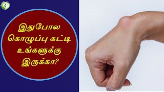 கொழுப்பு  கட்டி புற்றுநோயாக மாறுமா? lipoma in tamil