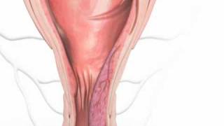 HAL-RAR Procedure for the Treatment of Haemorrhoids and Piles