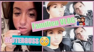 Familien Vlog ? Bluterguss an der Lippe ? Youtuberin hat mich versetzt ➡ Nickisbeautyworld