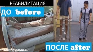 Травма Перелом Позвоночника | РЕАБИЛИТАЦИЯ | Lumbar Spine Fractures
