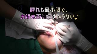 美乳豊胸 美脚くびれ脂肪吸引 二重専門 美容整形 口コミ 湘南美容外科 東京銀座院 長谷川院長 芸能人 モデル アイドル ダイエット バストアップ 若返り アイプチ 埋没法 新宿 池袋 渋谷