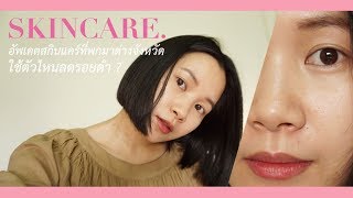 ใช้ตัวไหนลดรอยสิว ? อัพเดตสกินแคร์ที่พกมาต่างจังหวัด | Minimayy