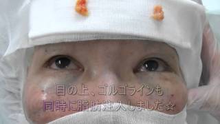 美乳豊胸 美脚くびれ脂肪吸引 二重専門 美容整形 口コミ 湘南美容外科 東京銀座院 長谷川院長 芸能人 モデル アイドル ダイエット バストアップ 若返り アイプチ 埋没法 新宿 池袋 渋谷