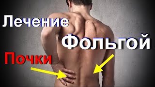 Лечение почек фольгой. Нетрадиционная медицина. Фольга лечит почки это невероятно