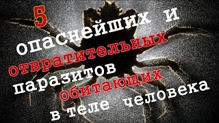 ToP 5 самых опасных и отвратительных паразитов, обитающих в теле человека! Слабонервным не смотреть!