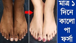 মাত্র  ১ বারে  কালো কালো পা কে দুধের মত ফর্সা করে দেবে ঘরে বানানো এই উপায়টি । Feet Whitening