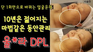 피부관리실 미용기기 울*라DPL페이스관리 시술영상 (하이프리프팅,윤곽)