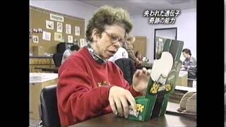 ウィリアムズ症候群ー1
