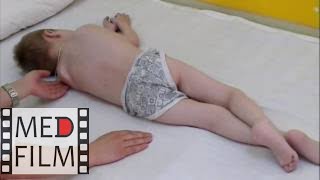 Митохондриальная миопатия у детей (осмотр) ©  Mitochondrial myopathy in children