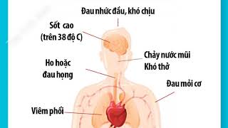 Triệu chứng Nhiễm virus corona