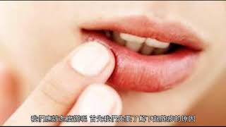 嘴上起泡泡怎麼辦？醫生：不只是上火，還可能是這種情況