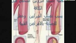 معجزة زيت الزيتون