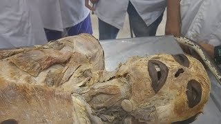 Human body dissection | part : 2 || Inferior Extremity || BD 24