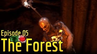 The Forest - Raging in the Woods! - Gameplay/Walkthrough #5