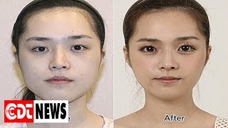 Mẹo chữa sụp mí tại nhà đơn giản mà hiệu quả không ngờ | CDT NEWS