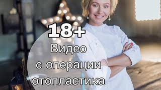 Отопластика
