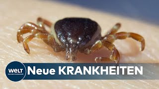 KLIMAWANDEL: Milde Winter bringen immer neue Zeckenarten nach Deutschland