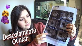 Descolamento Ovular | Caroline Faustino