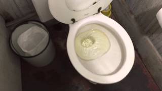 562. Forward Trap Toilet Flushathon of 2015.