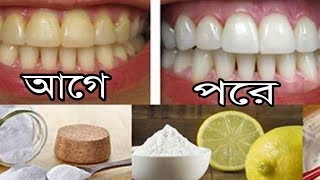 দাগ পড়েছে দাঁতে মাত্র ৩ মিনিটে করে ফেলুন ঝকঝকে দাঁত, ১০০ % কার্যকরী !