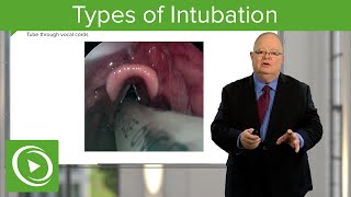 Types of Intubation  – Anesthesiology | Lecturio