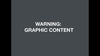 Yemen: Boy clings to dead father after Saudi-led coalition airstrike on wedding *GRAPHIC*