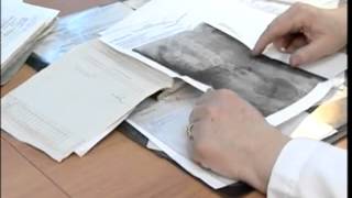Лечение мочекаменной болезни. Опыт реального пациента. НТВ.