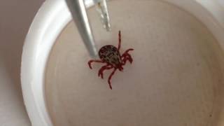 How To Remove A Tick From A Dog • Can you get lymes disease in Utah?