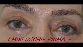 Blefaro/superiore - ^Occhi Nuovi^ ~la mia esperienza!
