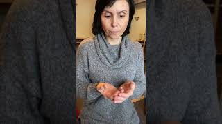 После правки с намерением ушли трещины на подушечках пальцев
