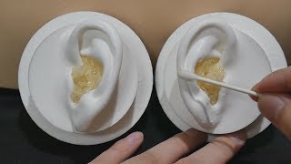 ASMR Your ears are full of earwax 7 - Pop Rocks / Popping Sound / Ear Cleaning (No Talking)