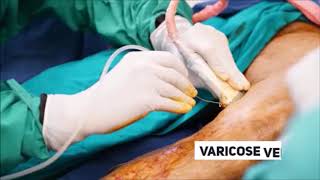 Maven Medical Center No.1 Advanced Daycare Laser Center in Hyderabad