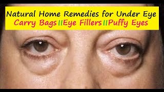 How to get rid of Under Eye Bags - 9 Excellent Home Remedies